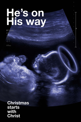 Babyscan